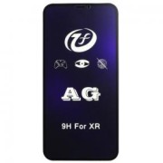 Нож выкидной деревянная рукоятка больш. A 562 A /12/ 442 Нож выкидной деревянная рукоятка больш. A 562 A /12/ 442